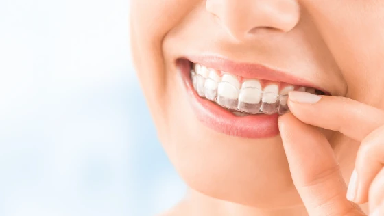 lady patient smiling after invisalign treatment in Cambridge, ON