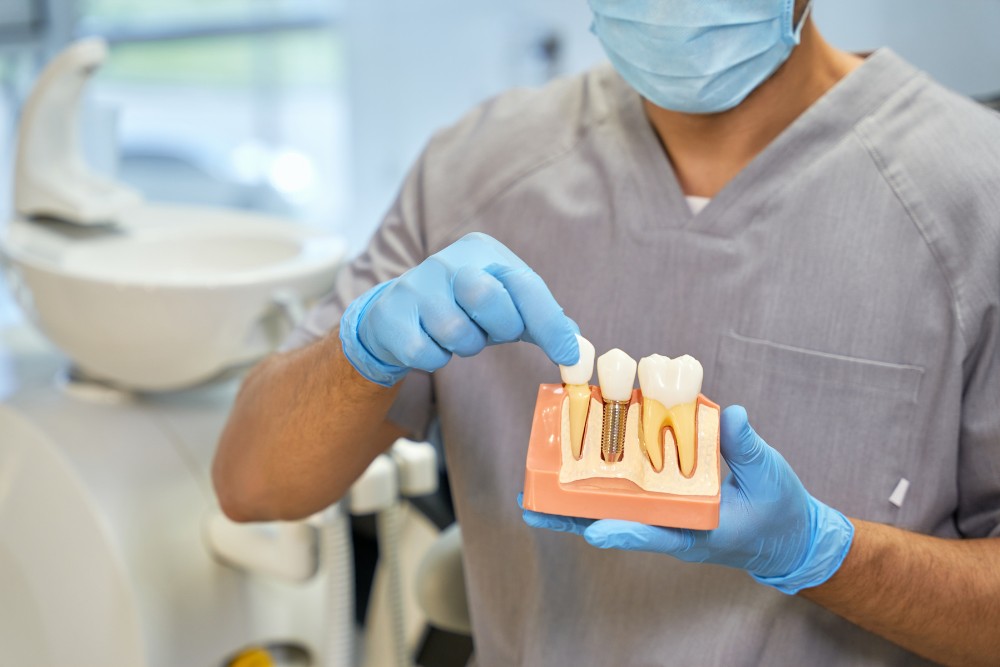 Life After Dental Implants: What to Expect