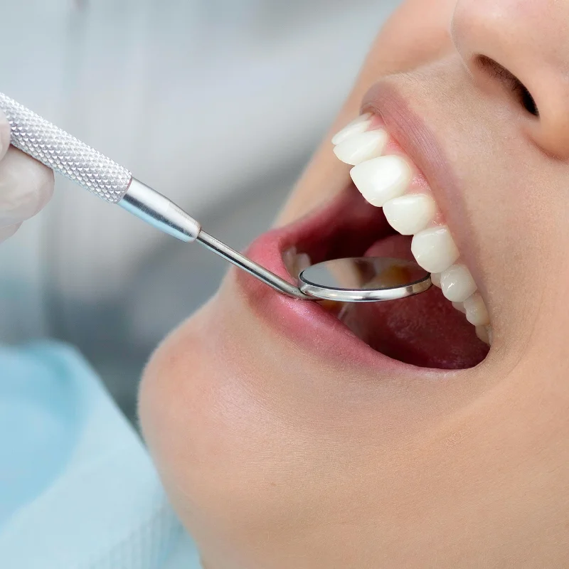 Dental Checkup Examination at Riverfront Dental Cambridge Ontario