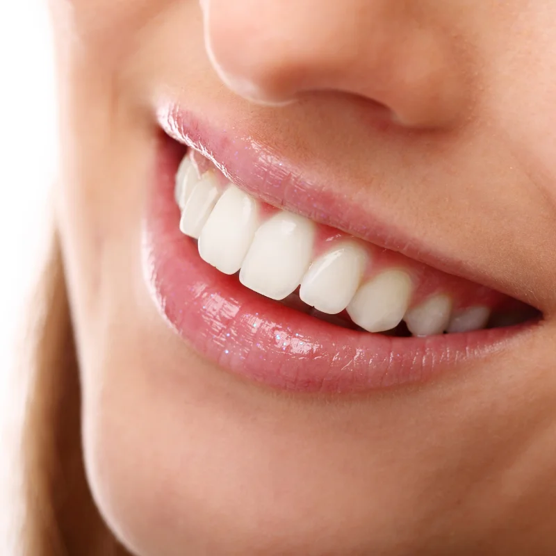 Bright white teeth after professional Philips Zoom teeth whitening at Riverfront Dental Cambridge