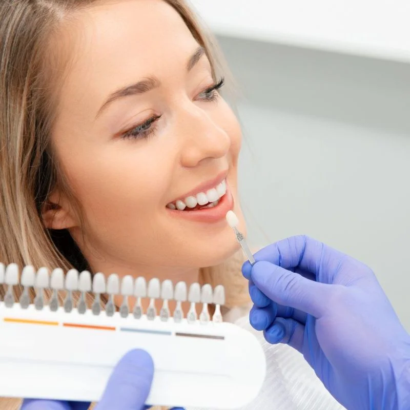 What are dental veneers at Riverfront Dental Cambridge