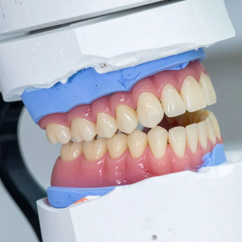 Close-up of a full denture model showing artificial teeth and gums used for denture treatment at Riverfront Dental in Cambridge Ontario